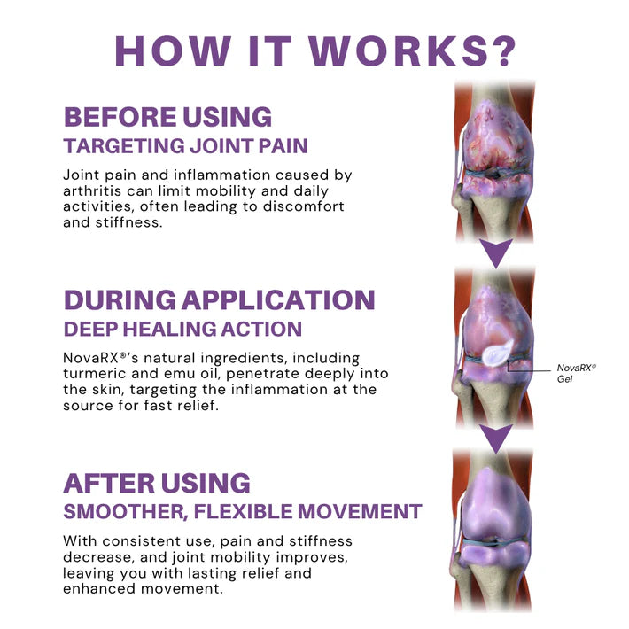 No Pain - Turmeric & Emu Oil Arthritis Soothing Pain Relief Massage Gel 👨‍⚕️ Australian Osteopathic Association (AOA) Approved
