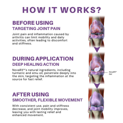 No Pain - Turmeric & Emu Oil Arthritis Soothing Pain Relief Massage Gel 👨‍⚕️ Australian Osteopathic Association (AOA) Approved